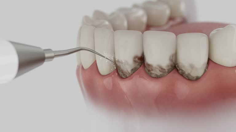 Reliable Teeth Cleaning And Checkup contractor in Fayette County County, IL by Dentist Open Now